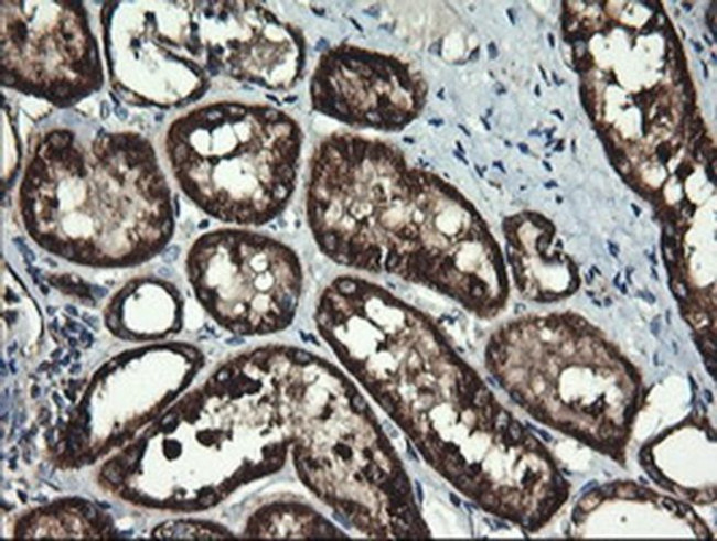 ACAA2 Antibody in Immunohistochemistry (Paraffin) (IHC (P))