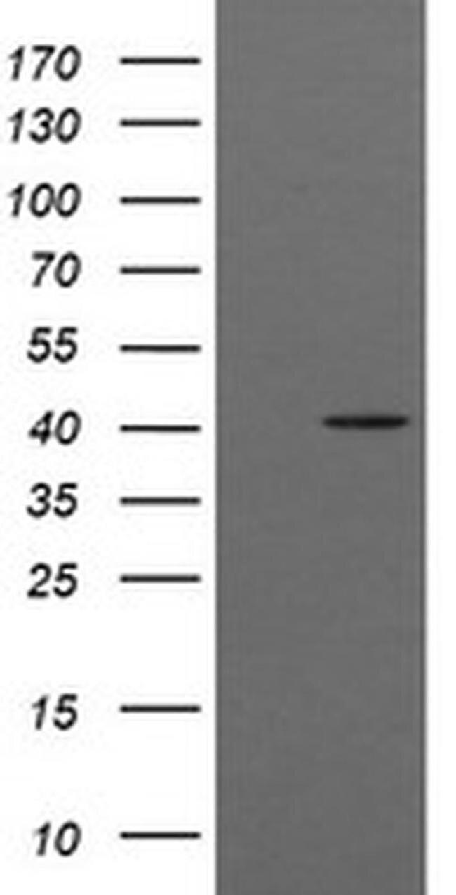 ACAA2 Antibody in Western Blot (WB)