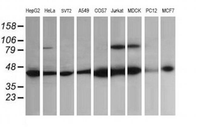 ACAA2 Antibody in Western Blot (WB)