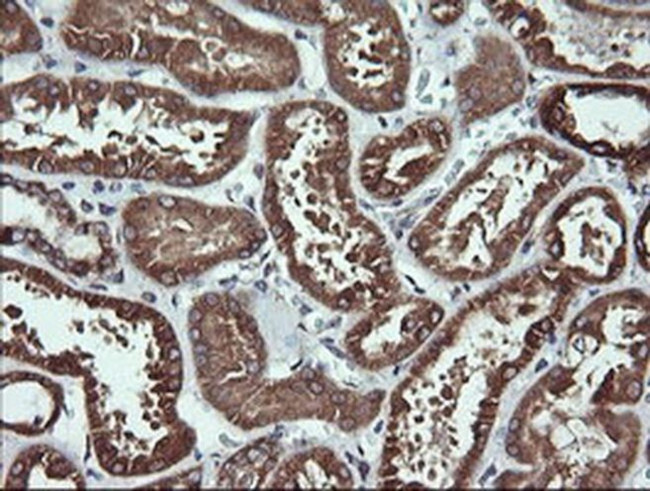 ACAA2 Antibody in Immunohistochemistry (Paraffin) (IHC (P))