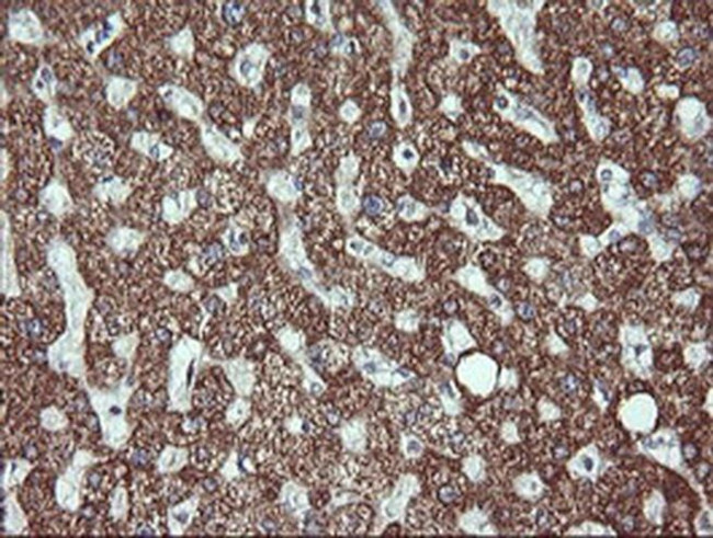 ACAA2 Antibody in Immunohistochemistry (Paraffin) (IHC (P))