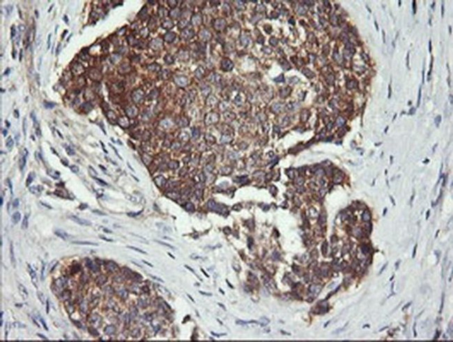 DNM1L Antibody in Immunohistochemistry (Paraffin) (IHC (P))