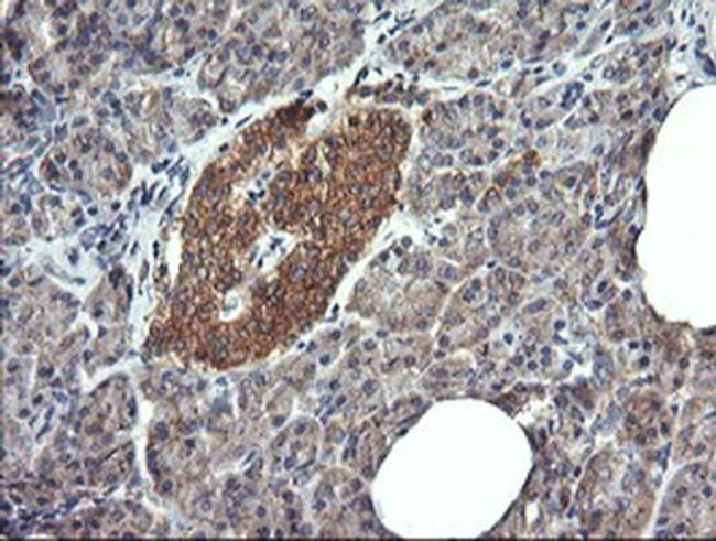 DNM1L Antibody in Immunohistochemistry (Paraffin) (IHC (P))