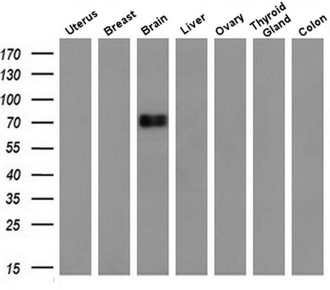 DNM1L Antibody in Western Blot (WB)