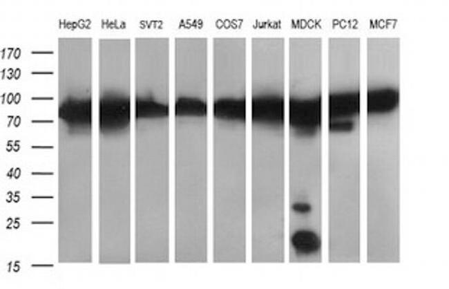 DNM1L Antibody in Western Blot (WB)