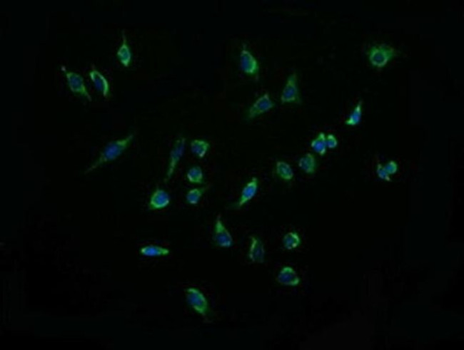 ACAA2 Antibody in Immunocytochemistry (ICC/IF)