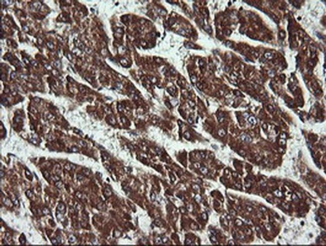 ACAA2 Antibody in Immunohistochemistry (Paraffin) (IHC (P))