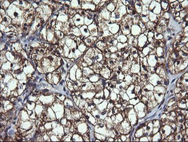 ACAA2 Antibody in Immunohistochemistry (Paraffin) (IHC (P))