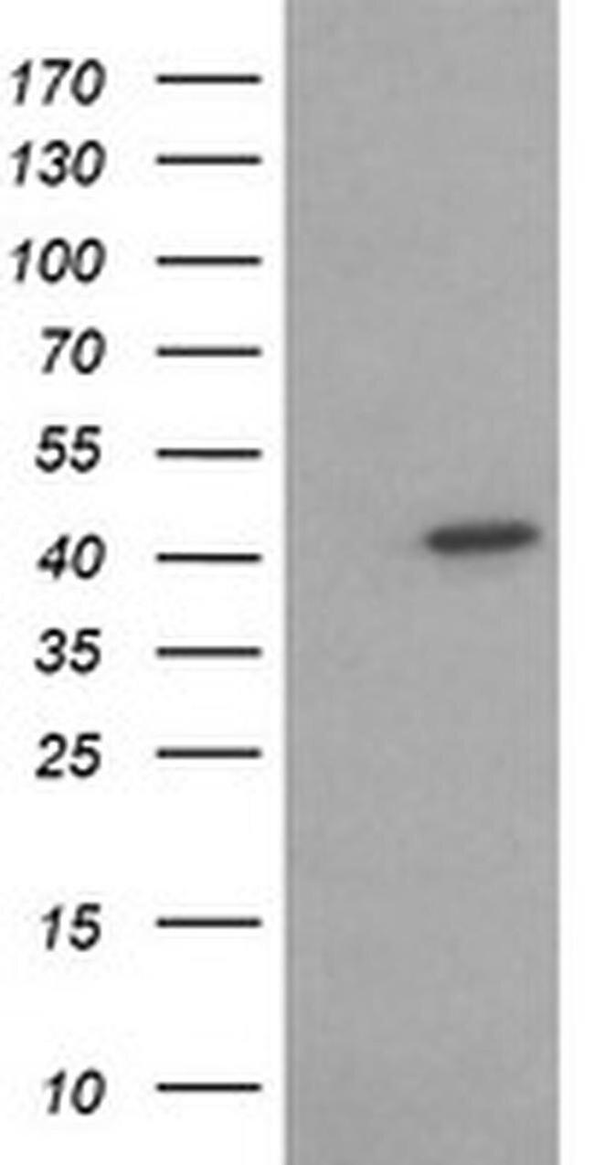 ACAA2 Antibody in Western Blot (WB)