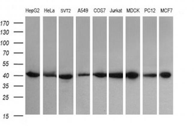 ACAA2 Antibody in Western Blot (WB)