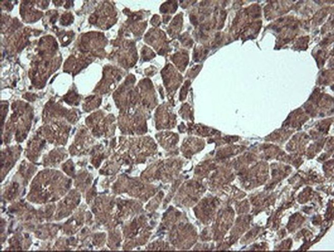 APC11 Antibody in Immunohistochemistry (Paraffin) (IHC (P))