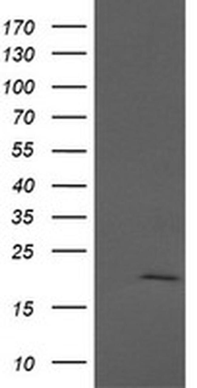 APC11 Antibody in Western Blot (WB)