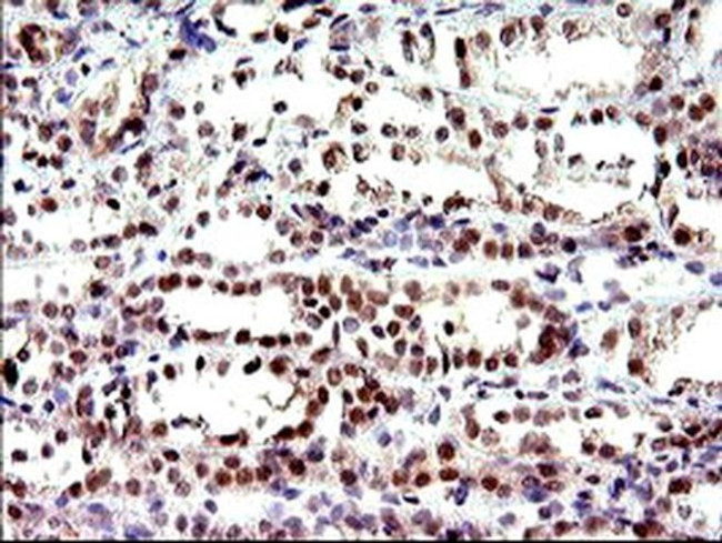 PMS2 Antibody in Immunohistochemistry (Paraffin) (IHC (P))