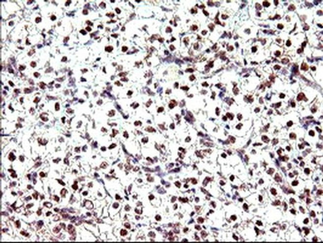 PMS2 Antibody in Immunohistochemistry (Paraffin) (IHC (P))