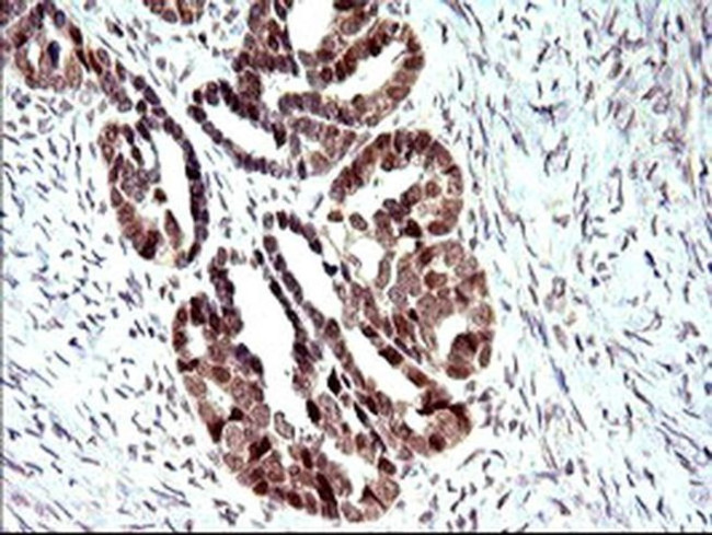 PMS2 Antibody in Immunohistochemistry (Paraffin) (IHC (P))