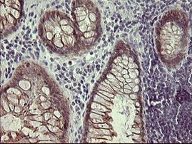 IFNGR2 Antibody in Immunohistochemistry (Paraffin) (IHC (P))