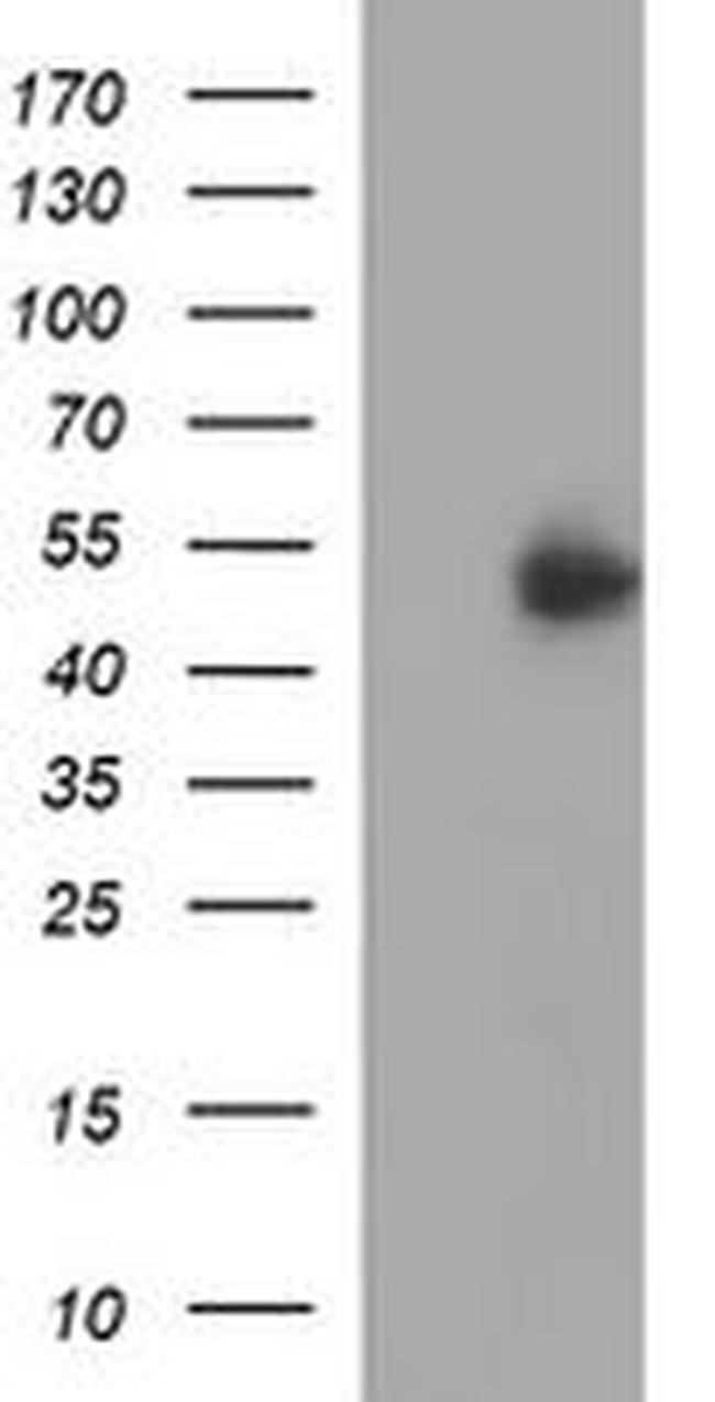 IFNGR2 Antibody in Western Blot (WB)