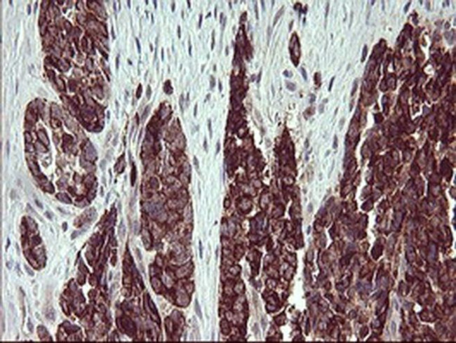 Arginase 2 Antibody in Immunohistochemistry (Paraffin) (IHC (P))