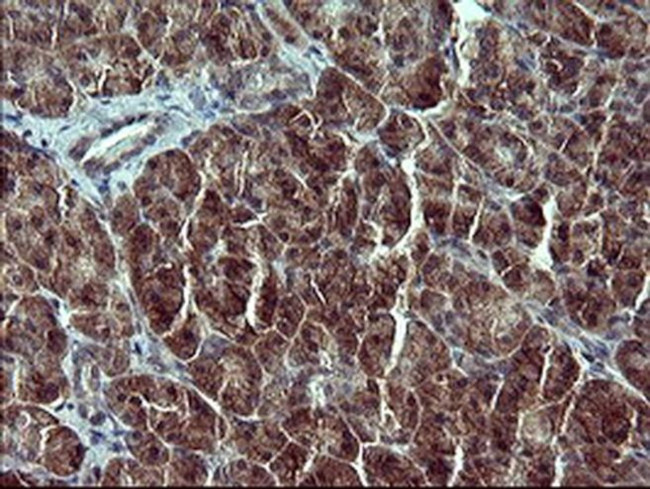 RUNDC3A Antibody in Immunohistochemistry (Paraffin) (IHC (P))