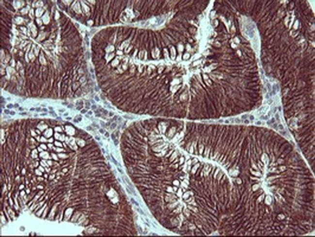 RUNDC3A Antibody in Immunohistochemistry (Paraffin) (IHC (P))