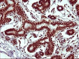 RAPGEF1 Antibody in Immunohistochemistry (Paraffin) (IHC (P))