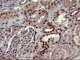 RAPGEF1 Antibody in Immunohistochemistry (Paraffin) (IHC (P))