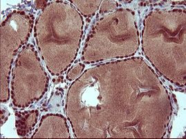 RAPGEF1 Antibody in Immunohistochemistry (Paraffin) (IHC (P))