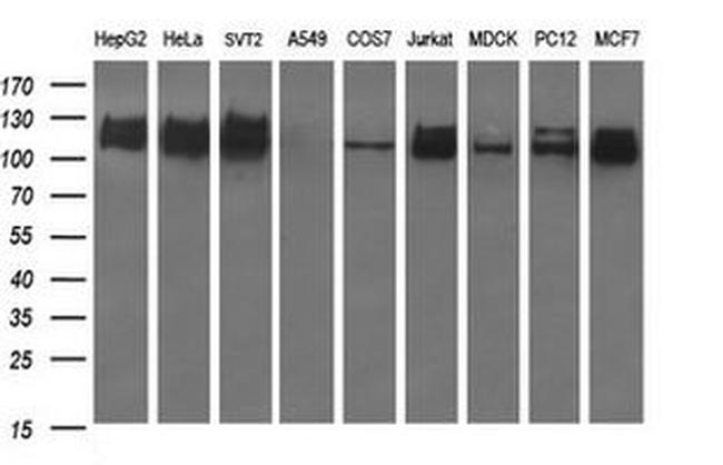 RAPGEF1 Antibody in Western Blot (WB)