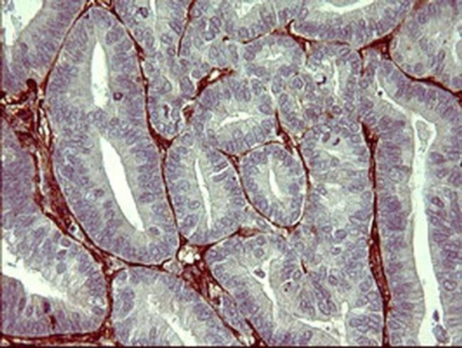 PPAP2A Antibody in Immunohistochemistry (Paraffin) (IHC (P))