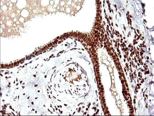 POLR3GL Antibody in Immunohistochemistry (Paraffin) (IHC (P))