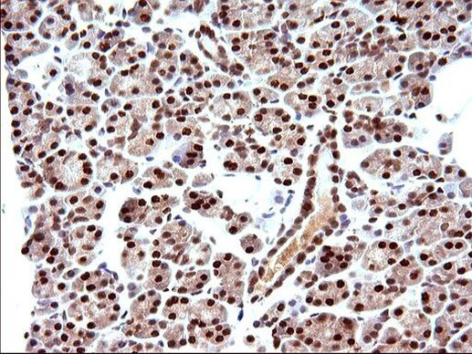 POLR3GL Antibody in Immunohistochemistry (Paraffin) (IHC (P))