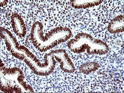 POLR3GL Antibody in Immunohistochemistry (Paraffin) (IHC (P))