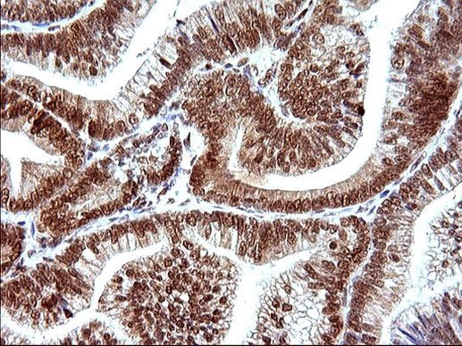 POLR3GL Antibody in Immunohistochemistry (Paraffin) (IHC (P))