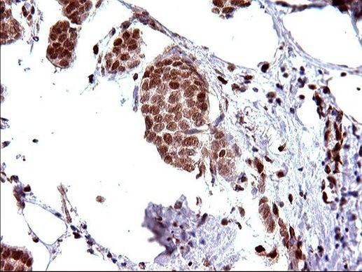 POLR3GL Antibody in Immunohistochemistry (Paraffin) (IHC (P))