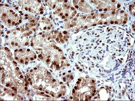 POLR3GL Antibody in Immunohistochemistry (Paraffin) (IHC (P))