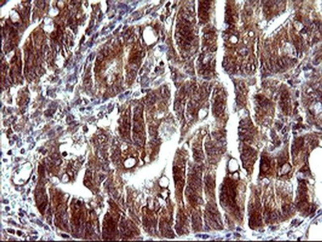 SERPINB3 Antibody in Immunohistochemistry (Paraffin) (IHC (P))