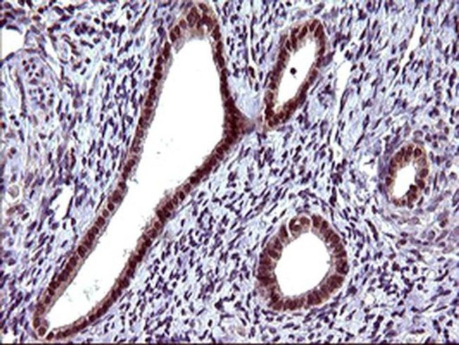 SERPINB3 Antibody in Immunohistochemistry (Paraffin) (IHC (P))