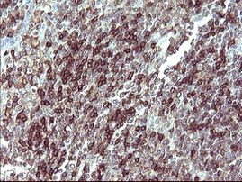 IL10RA Antibody in Immunohistochemistry (Paraffin) (IHC (P))