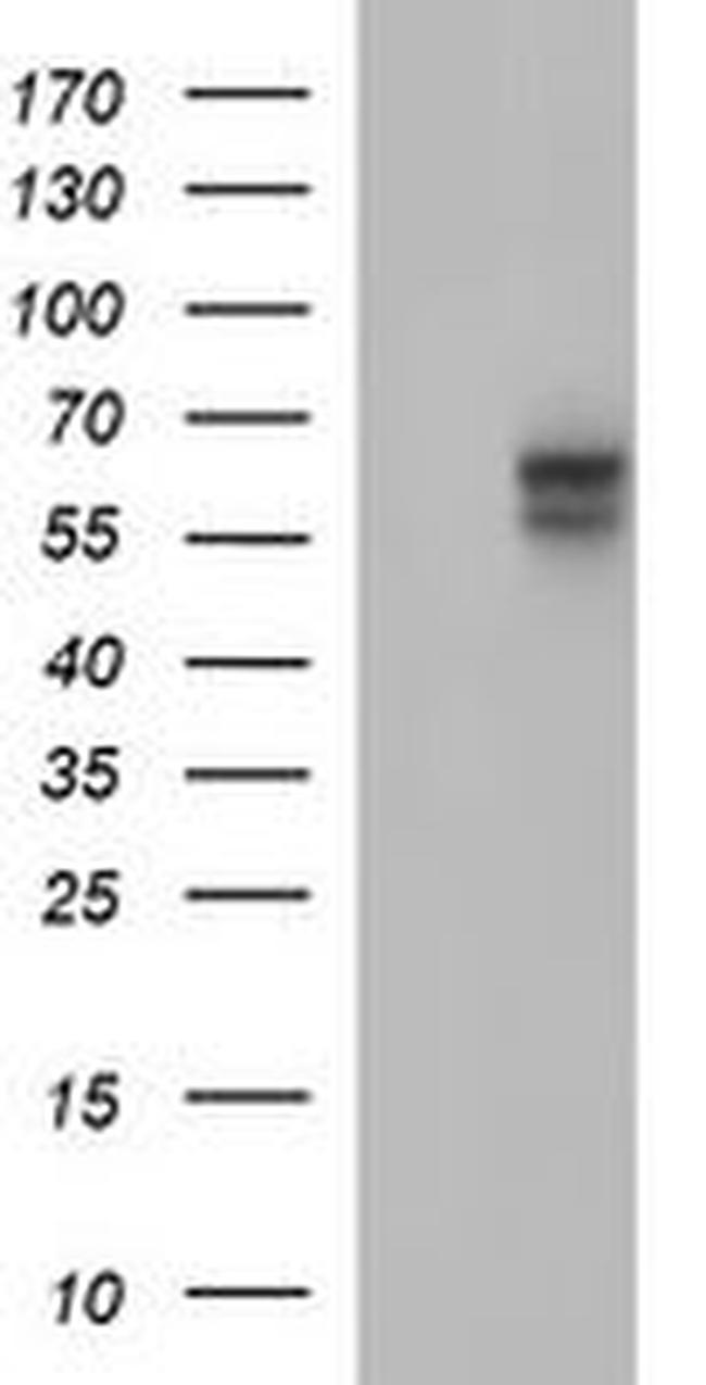 IL10RA Antibody in Western Blot (WB)