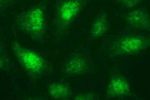 Necdin Antibody in Immunocytochemistry (ICC/IF)