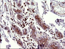 SCAMP2 Antibody in Immunohistochemistry (Paraffin) (IHC (P))