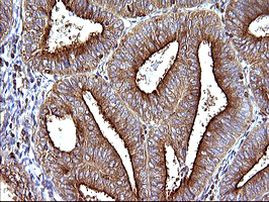 SCAMP2 Antibody in Immunohistochemistry (Paraffin) (IHC (P))