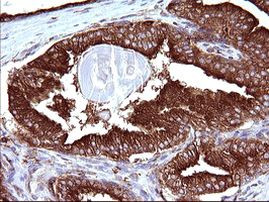 SCAMP2 Antibody in Immunohistochemistry (Paraffin) (IHC (P))