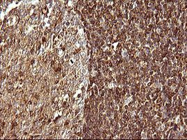 SCAMP2 Antibody in Immunohistochemistry (Paraffin) (IHC (P))