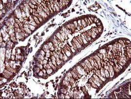 SCAMP2 Antibody in Immunohistochemistry (Paraffin) (IHC (P))