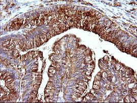 SCAMP2 Antibody in Immunohistochemistry (Paraffin) (IHC (P))