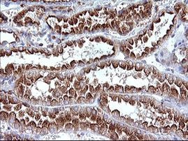 SCAMP2 Antibody in Immunohistochemistry (Paraffin) (IHC (P))