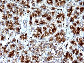 SCAMP2 Antibody in Immunohistochemistry (Paraffin) (IHC (P))