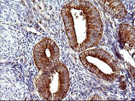 SCAMP2 Antibody in Immunohistochemistry (Paraffin) (IHC (P))