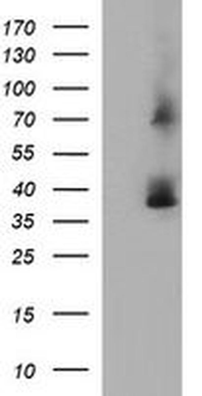 SCAMP2 Antibody in Western Blot (WB)
